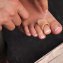 Gel-Schlauch-Bandage - 1