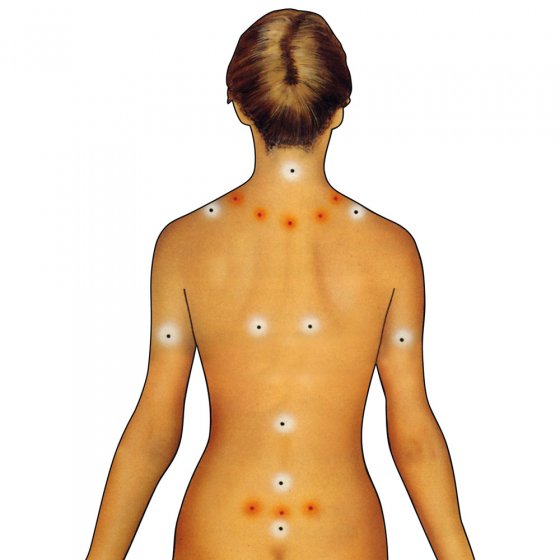 Schröpf-Therapiegerät „Vacu-Med“