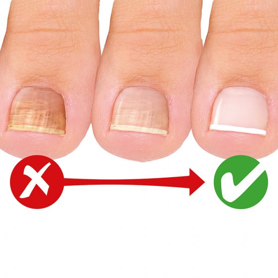 Medo Nail