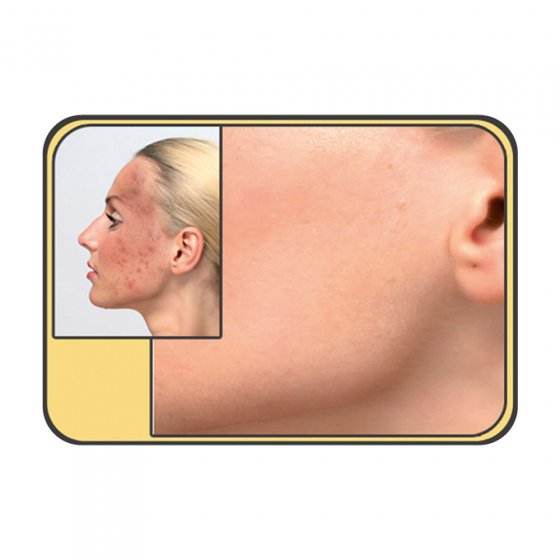 Gesichtscreme "Anti-Redness"