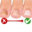 Medo Nail - 2