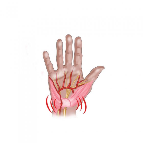 Handgelenkbandage