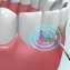 Zahnreiniger „Dental Pic Sonic” - 4