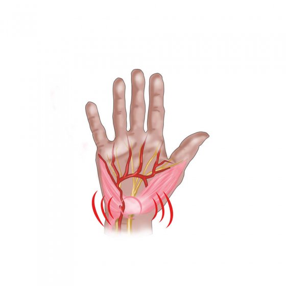 Handgelenkbandage